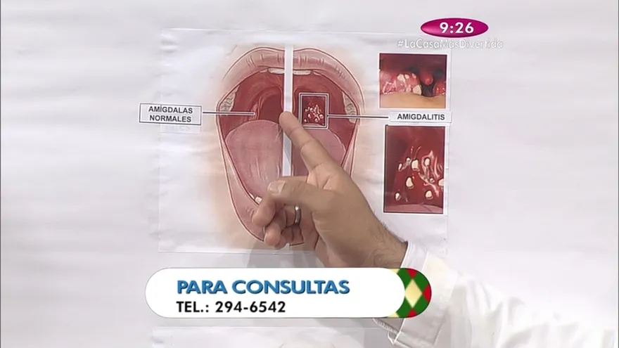 Salud al día - Faringitis sus síntomas y cómo tratarla