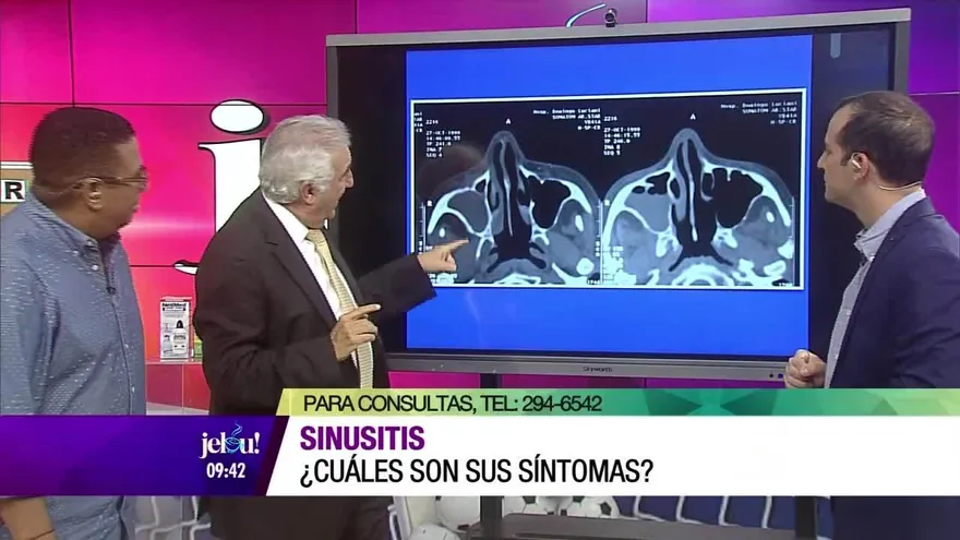 Sinusitis ¿Cuáles son sus síntomas?